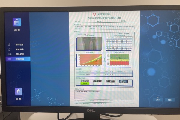 骨密度低怎么辦？養(yǎng)成良好生活習(xí)慣，從多方面增強(qiáng)骨密度